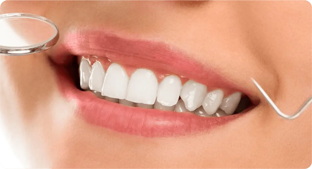 dentasmile pro user white teeth